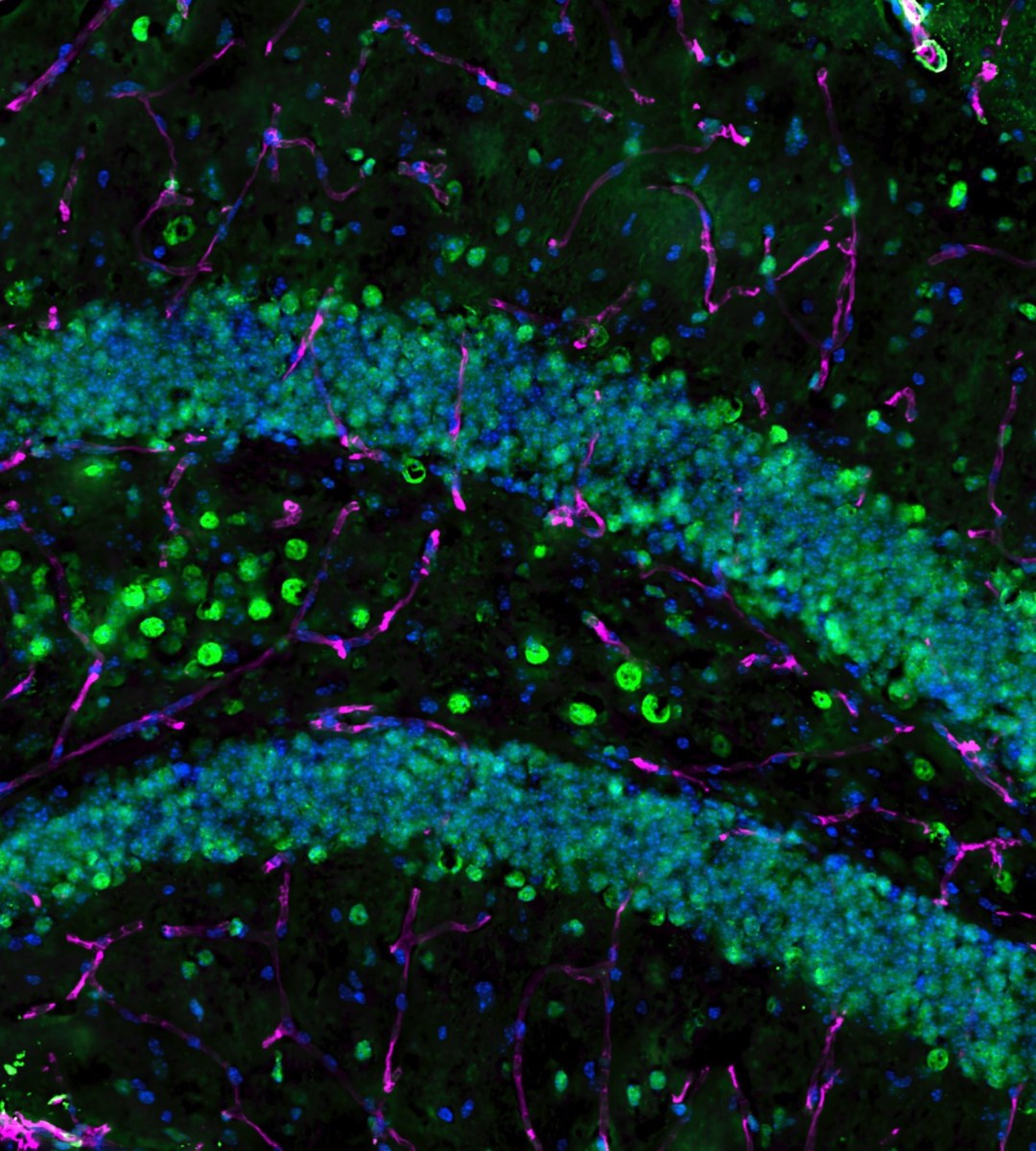 Fluorescent microscopy image of brain tissue