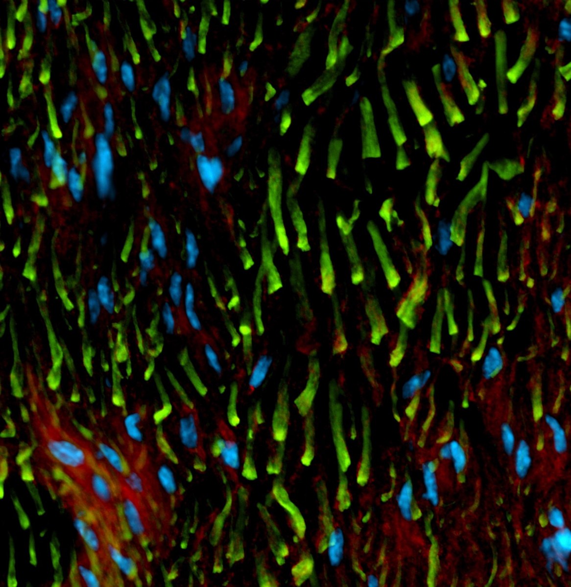 Fluorescence microscopy featuring green fibers and blue nuclei