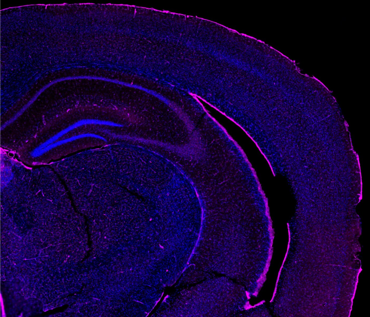 Purple and blue microscopy image of a brain section