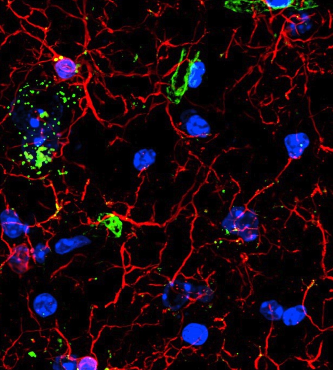 Fluorescence microscopy featuring cellular networks and blue nuclei